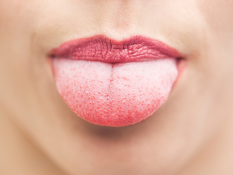 what-causes-tongue-discolorations-danville-family-dentistry