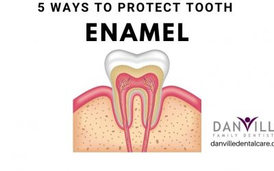 5 Best Ways to Prevent Tooth Enamel Erosion