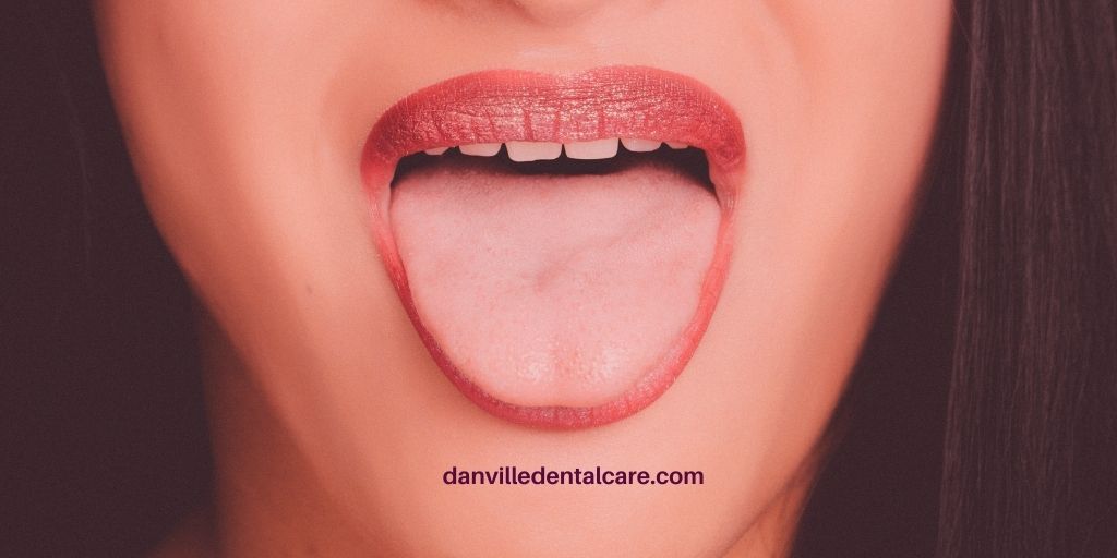Salivary gland stones play havoc with saliva and oral health.
