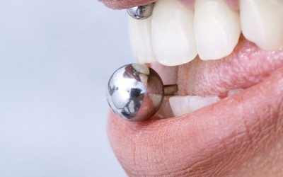 How Oral Piercing Affects Your Dental Health