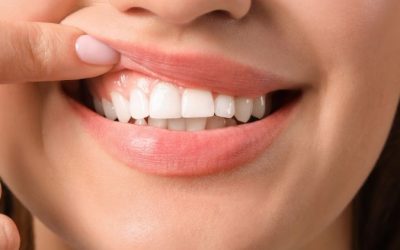 How to Triumph Over Gum Disease