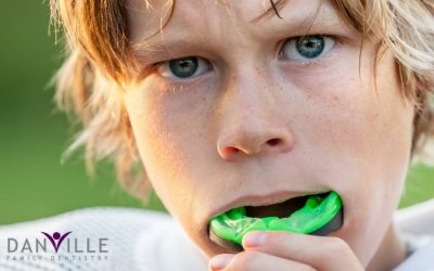 Mouth Guards: Safety is the Best Fit